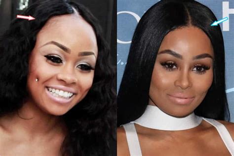 blac chyna before and after fame|The Transformation Of Blac Chyna From A Teenager。